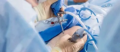 Laparoscopic Surgery Department