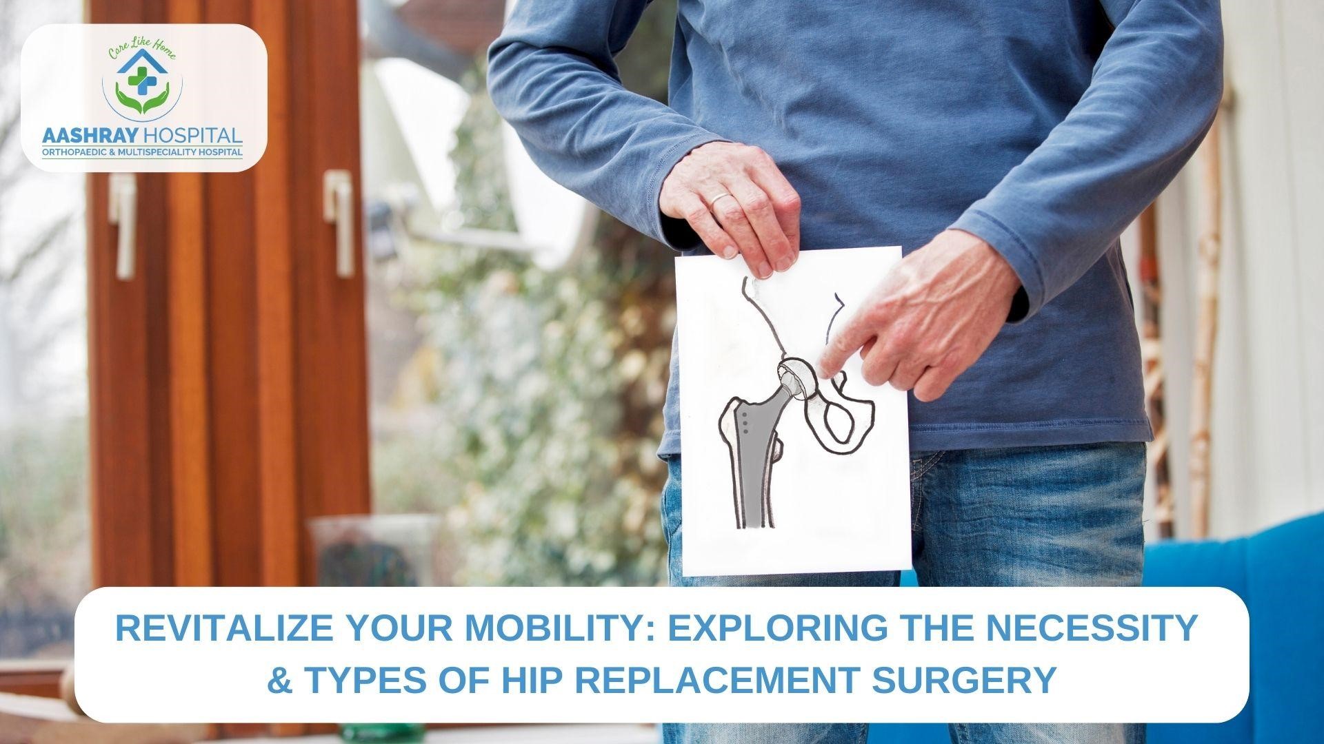Hip Replacement Surgery