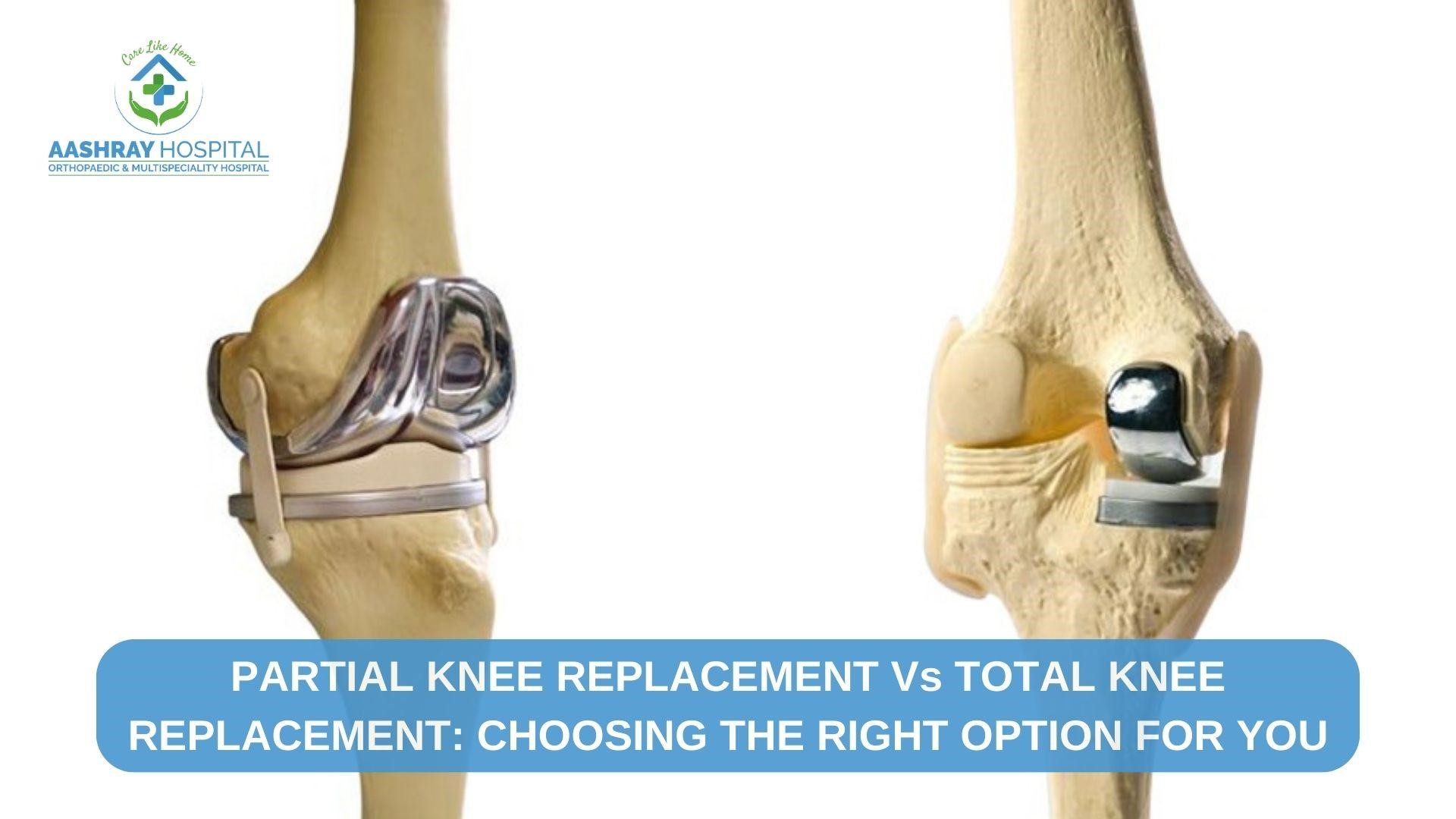 orthopaedic hospitals